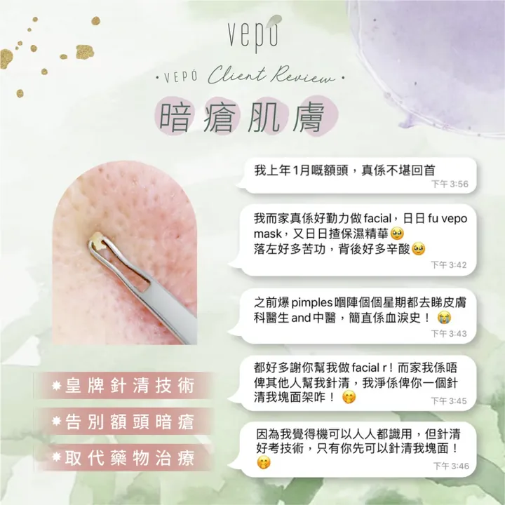 Vepó 客人分享的對話截圖，主題為暗瘡肌膚與皇牌針清療程